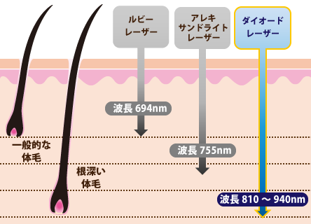 レーザーの種類と波長