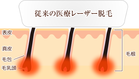 顔、足、わき。部位や個人でさまざまな毛質があります。