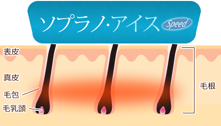 顔、足、わき。部位や個人でさまざまな毛質があります。