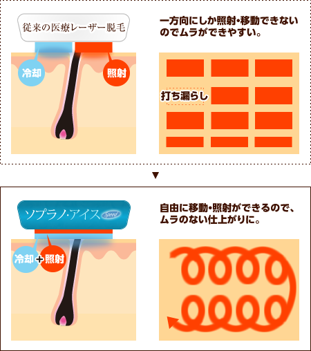 顔、足、わき。部位や個人でさまざまな毛質があります。